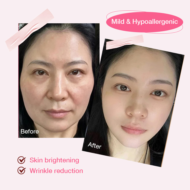 BUY NOW GET GINSENG SOAP FREE-ELLEN ELLA GlowCycle Cream Combo -Niacinamide Cream for Morning Boost, 3-in-1 Tone up Cream for Day Glow, Retinol Cream for Night Renew - Get rid of dull and aging skin